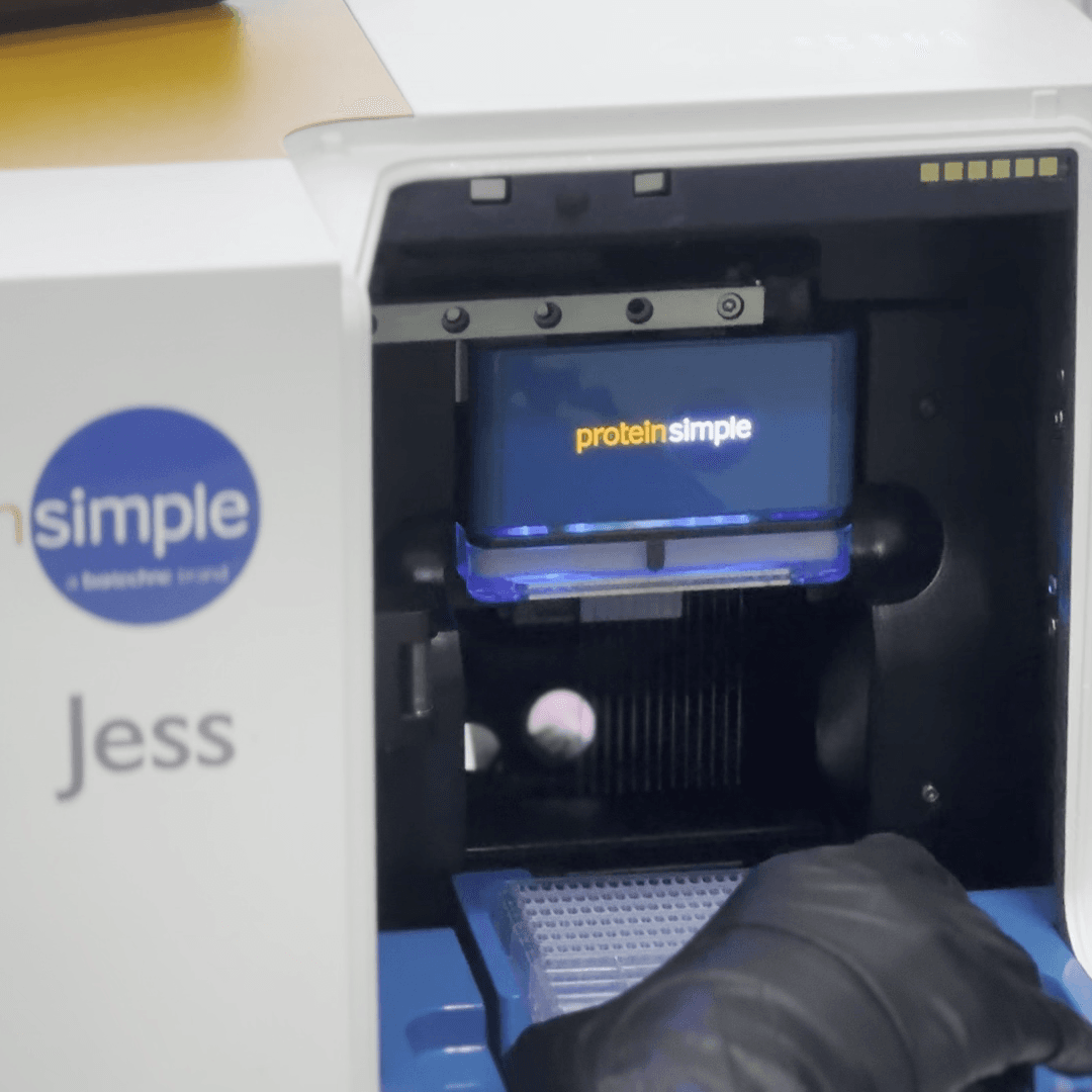Jess (Automated Western Blotting)